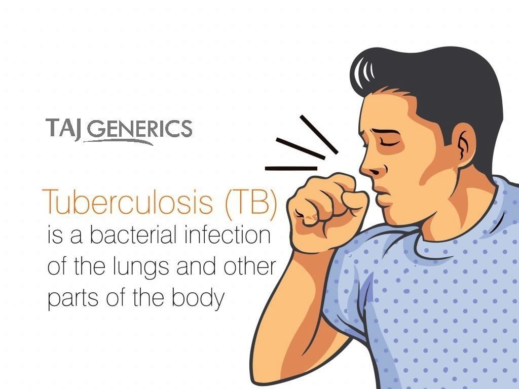 Tuberculosis