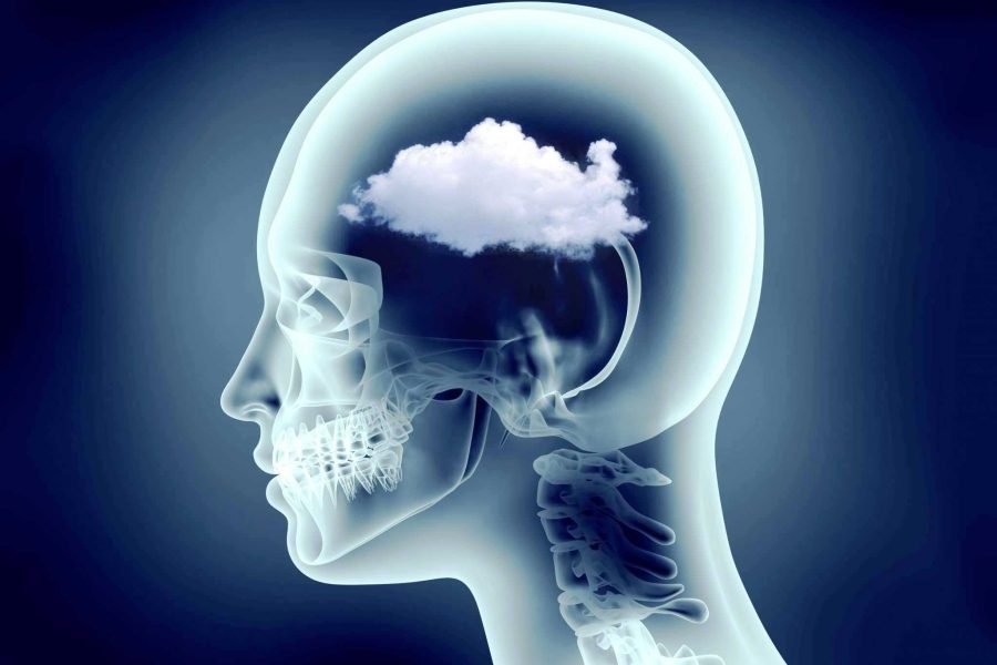 Brain Fog- Foggy Head Anxiety Symptoms