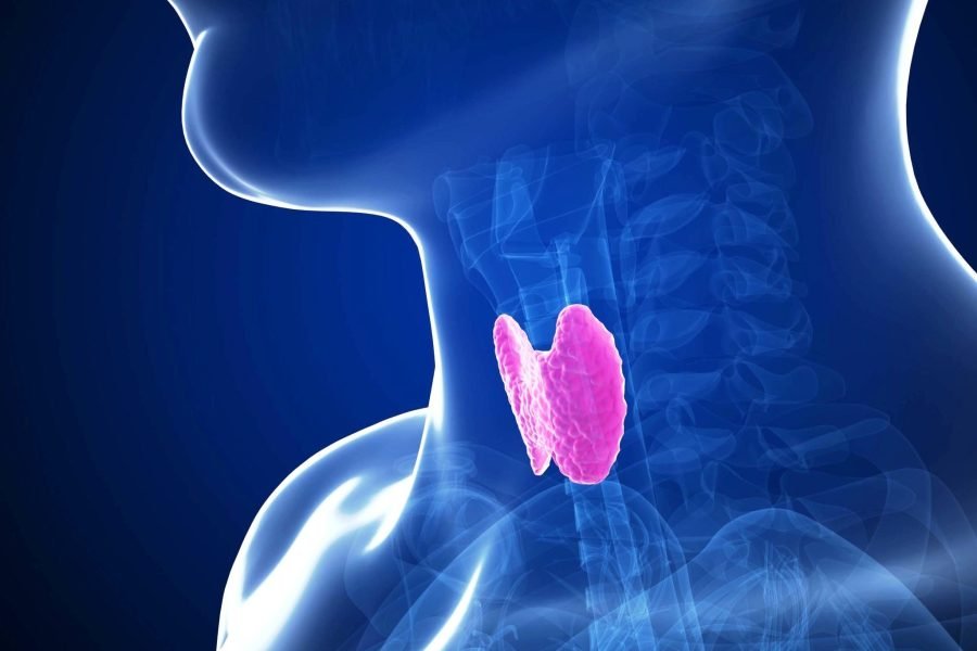 Untreated Hypothyroidism: The silent killer